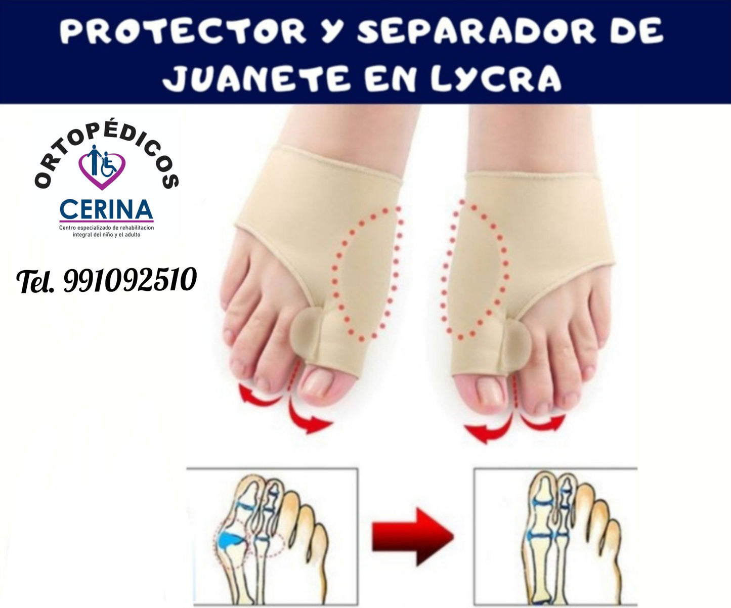 Separador con Protector de Juanete Con Gel y Lycra