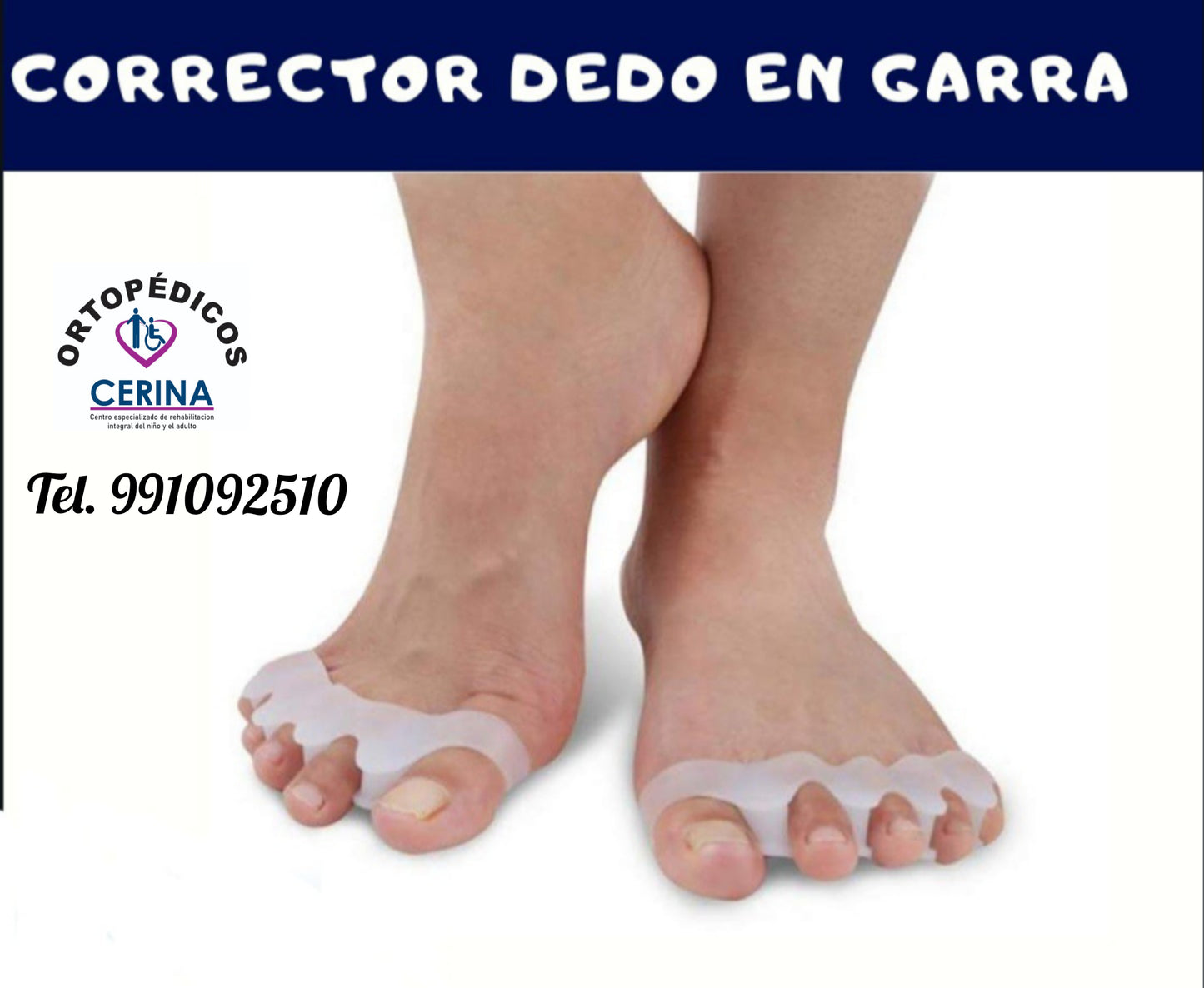 Corrector dedo en Garra